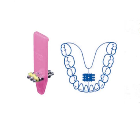 Torn expansor univer leone a0800