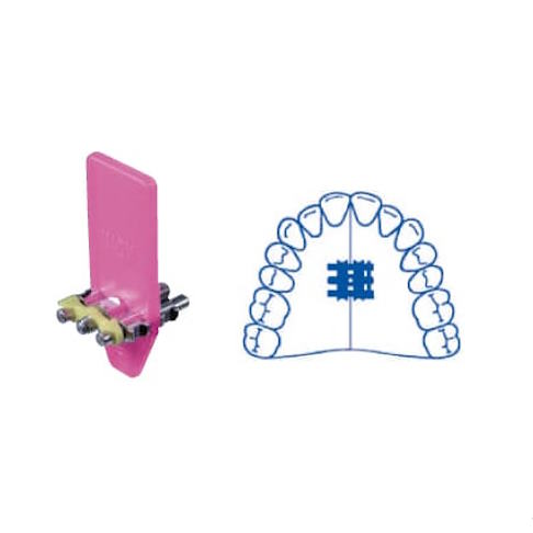 Torn expansor superior leone a0805