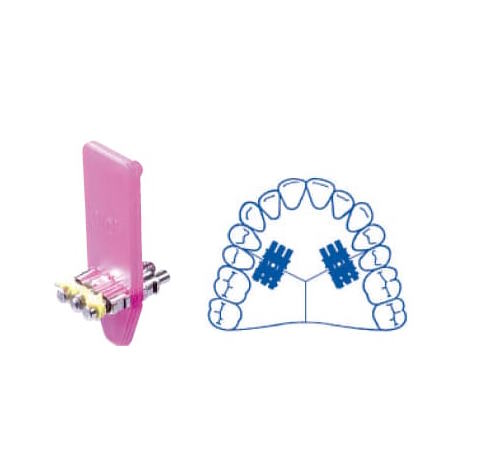 Torn expansor medio leone a0803